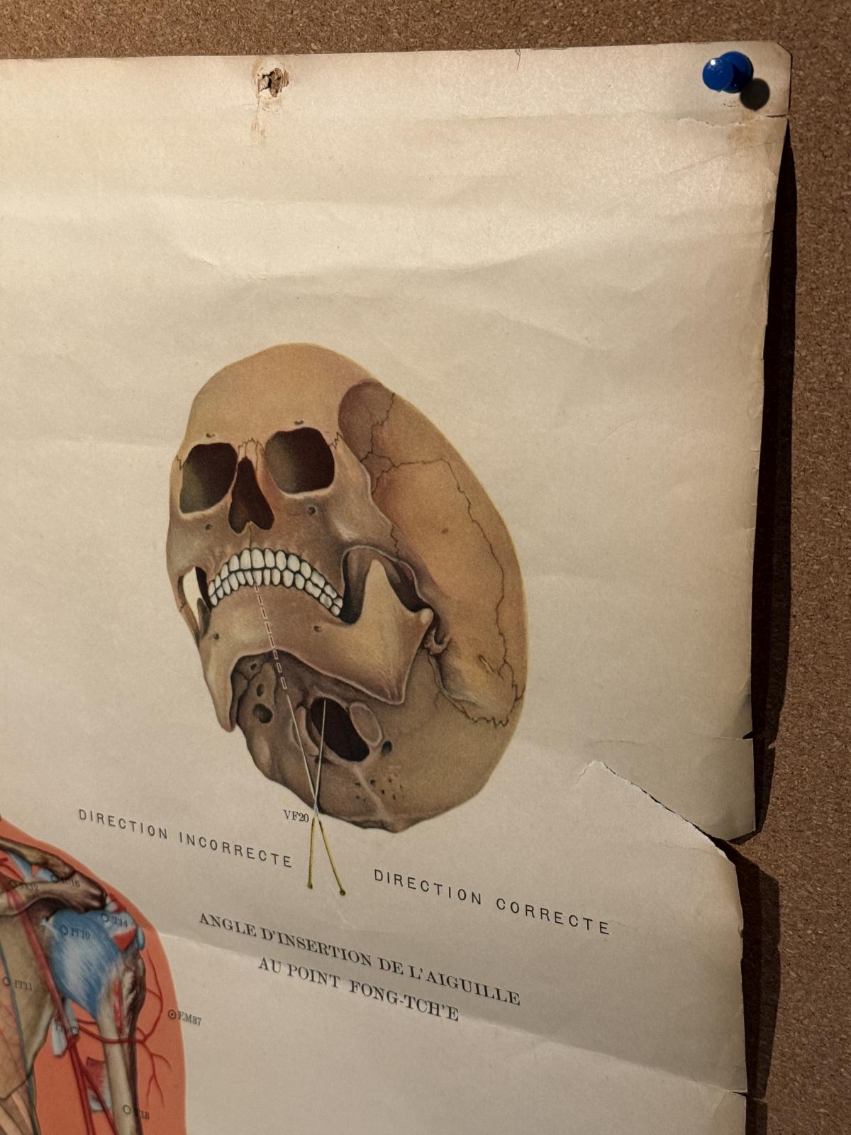 Planșă vintage de acupunctură din China, cu anatomia corpului văzut din spate și explicații în franceză. Anii 1970, 65 × 105 cm.